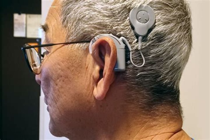 Are cochlear implants invisible