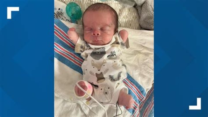 Can a baby be born without a bladder