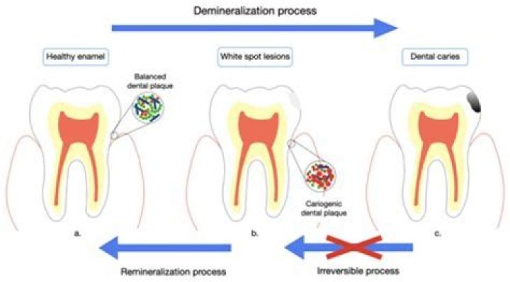 Can enamel be used on induction