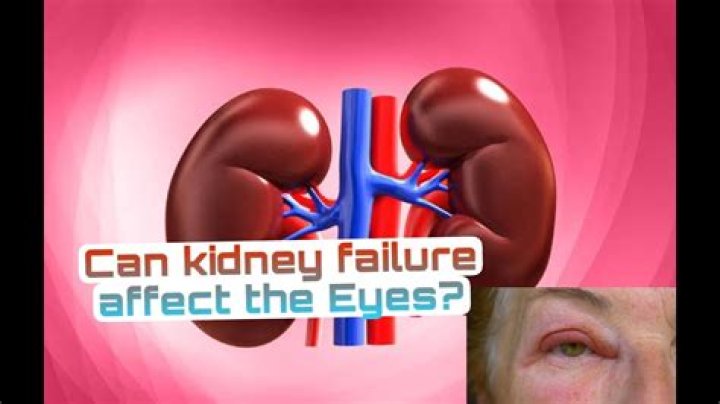 Can kidney problems cause strep throat