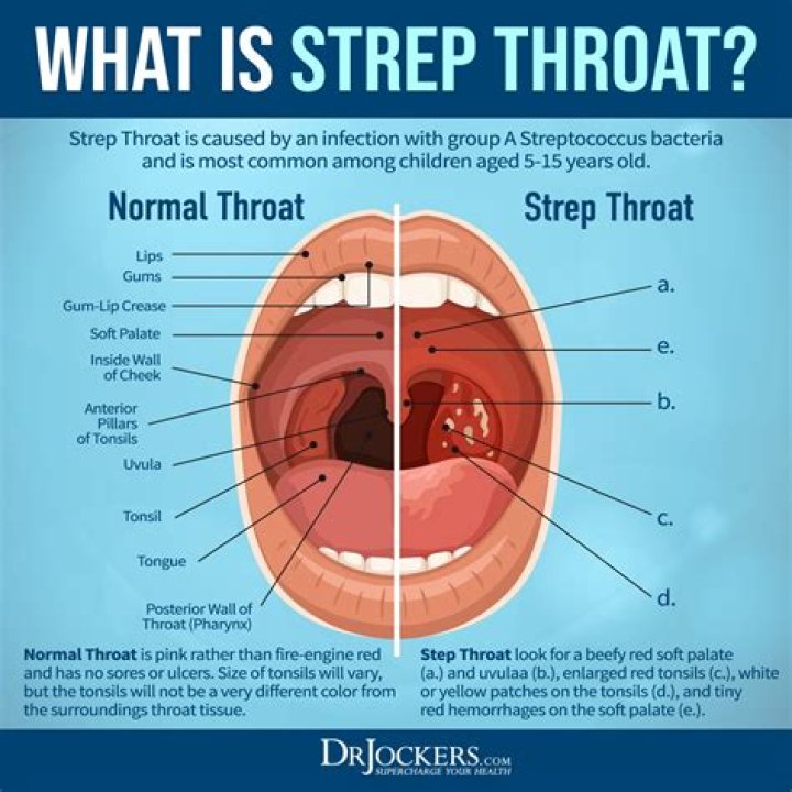 Can MRSA affect the throat