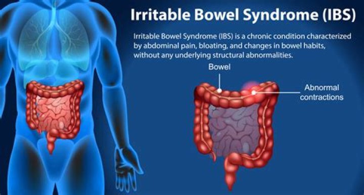Can sorbitol cause IBS