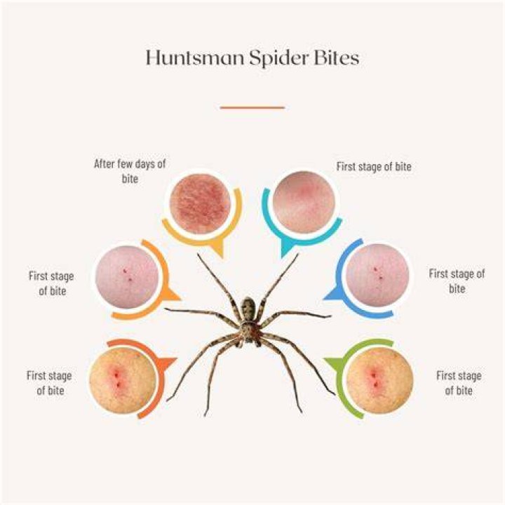 Do Huntsman spiders bite