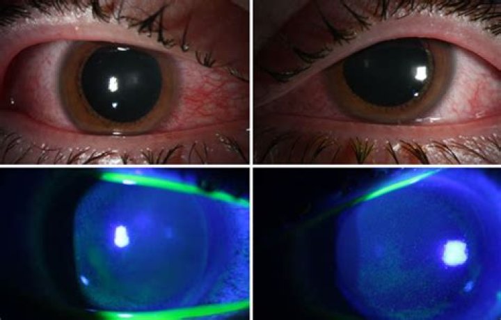 Do LED lights hurt your eyes