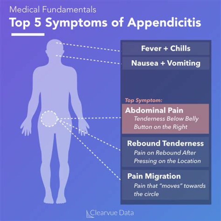 Does appendicitis have rebound tenderness