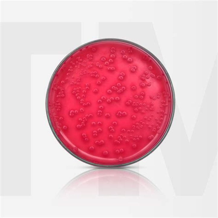 Does E coli grow on SS agar