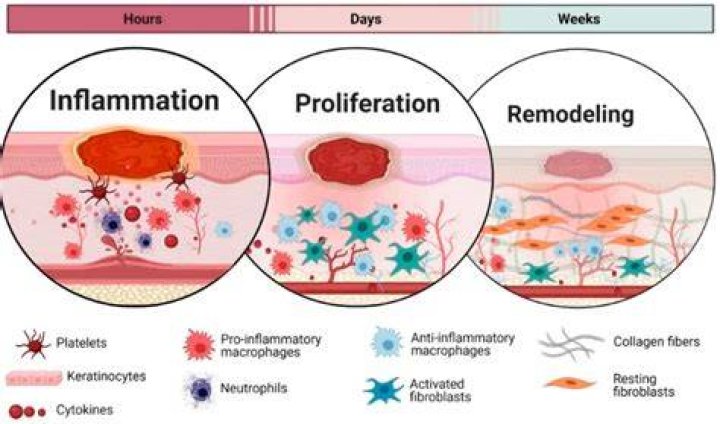 Does inflammation repair damaged tissue
