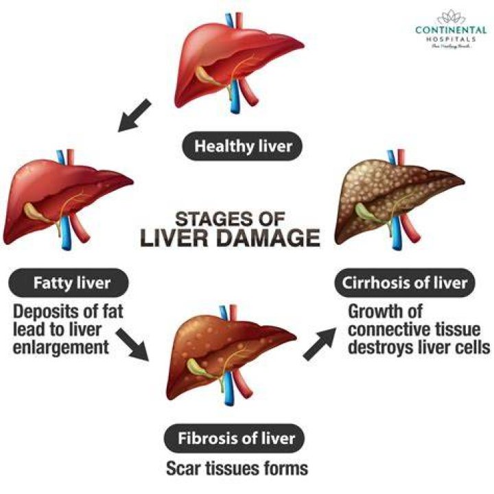 Does tea cause liver damage
