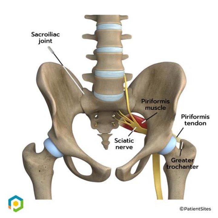 Does the sciatic nerve pass through the piriformis
