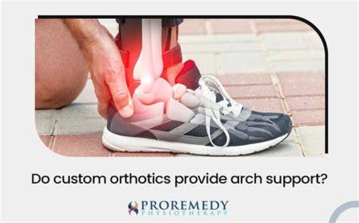 Does Tieks provide arch support