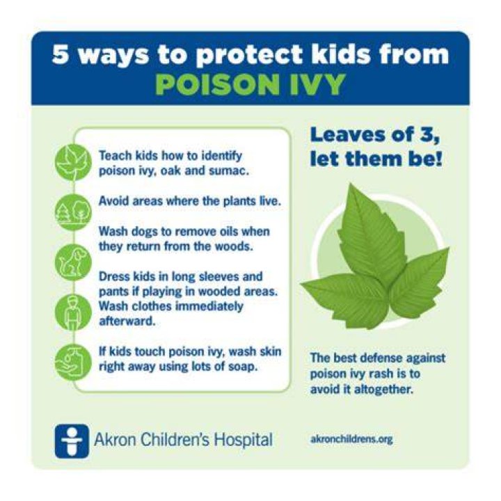 Does toothpaste treat poison ivy