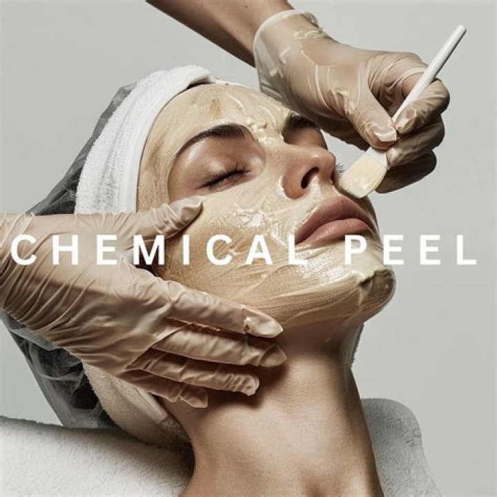 Does whitewash peel