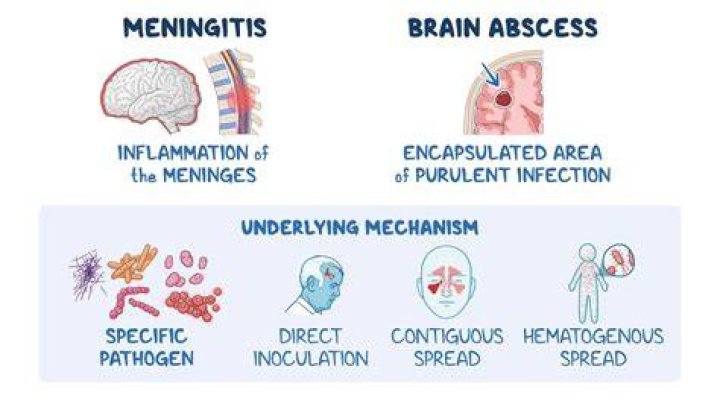 How do adults get meningitis