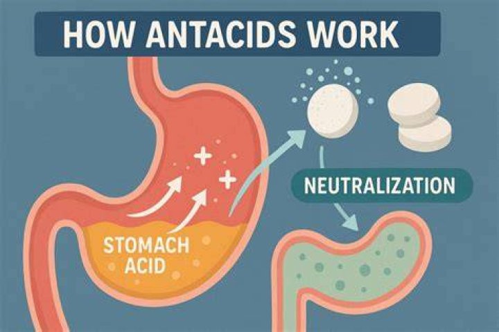 How do antacids neutralize stomach acid