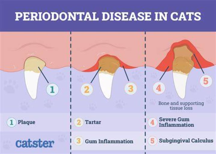 How do you compute for plaque index per tooth