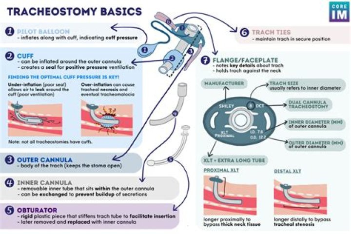 How do you confirm a tracheostomy placement
