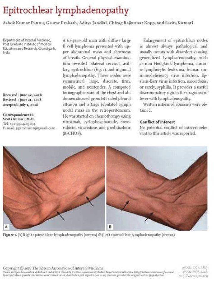 How do you examine Epitrochlear lymph nodes