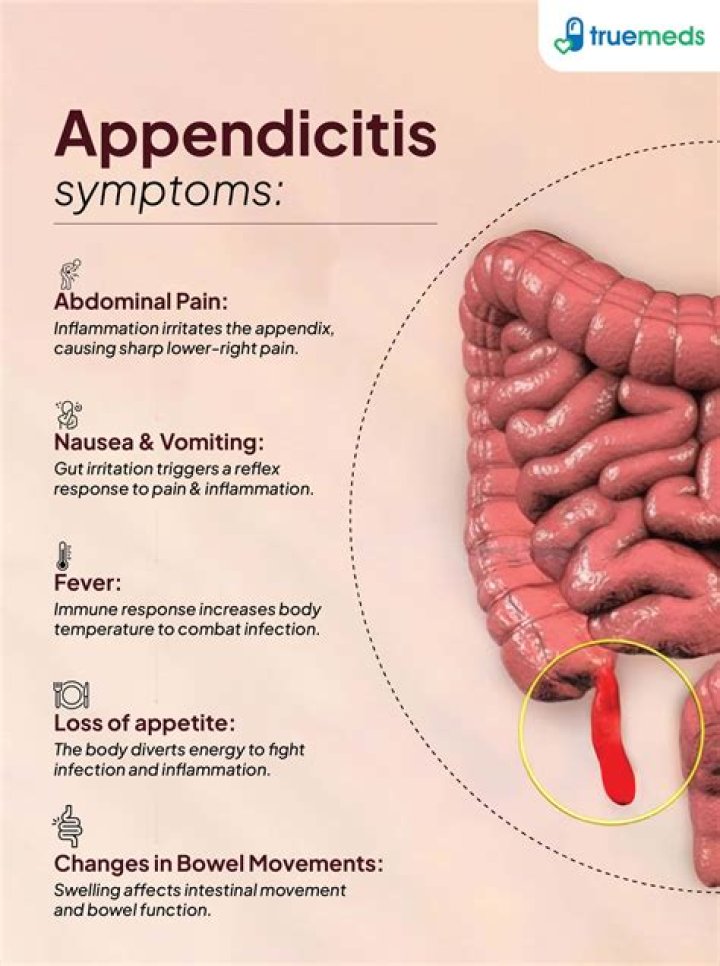 How do you feel when you have appendicitis