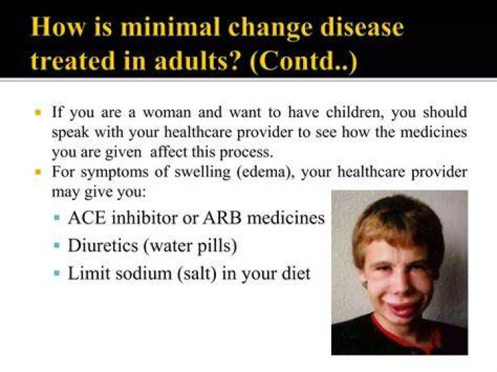 How do you get minimal change disease