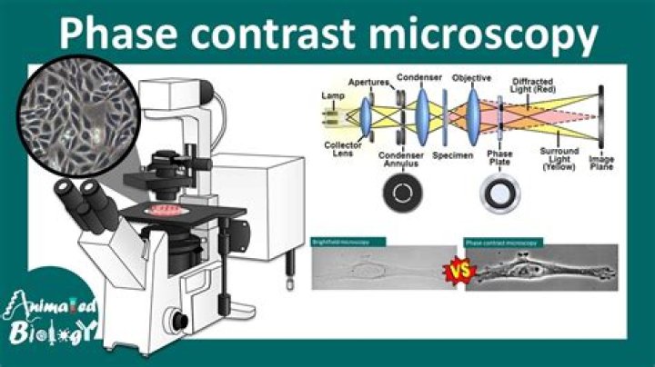 How do you set phase contrast microscopy