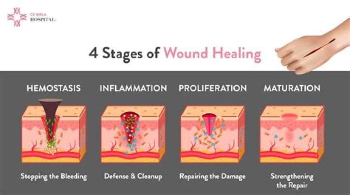 How do you stop a wound from oozing