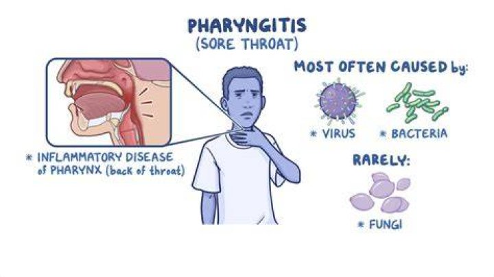 How do you treat allergic pharyngitis