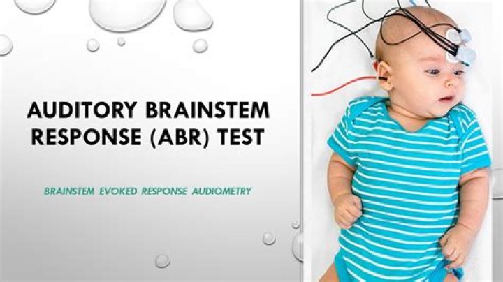 How does ABR test work