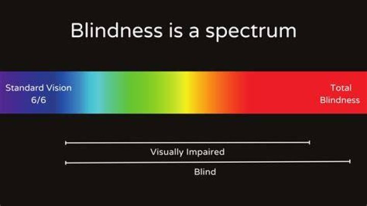 How does blindness vision function as a symbol in Oedipus the King