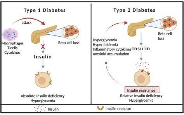 How does Type 1 diabetes affect the digestive system