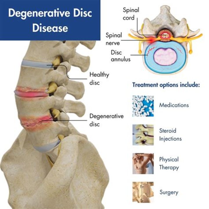 How fast does degenerative disc disease progress in dogs