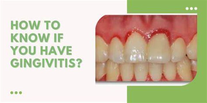 How long can you live with gingivitis
