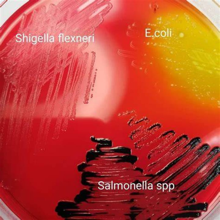 Is E coli the same as salmonella
