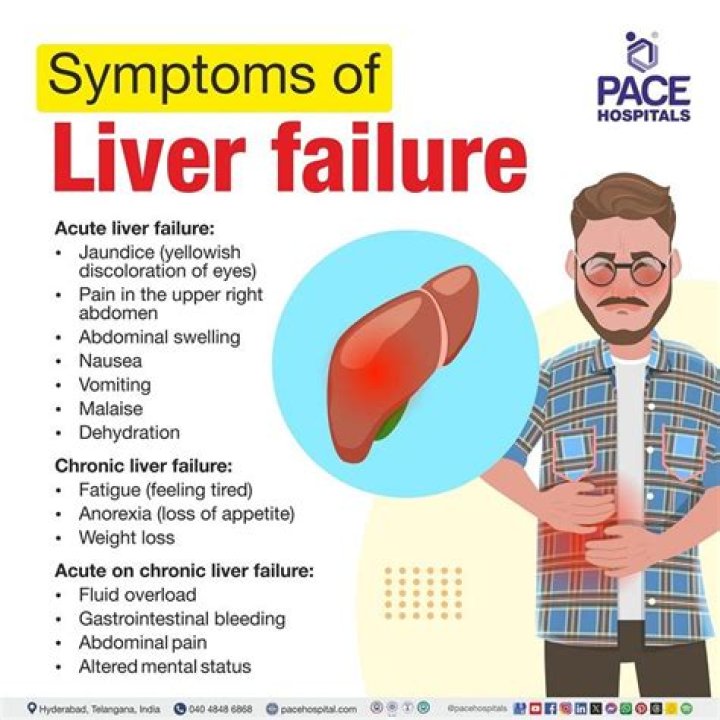 Is liver failure bad