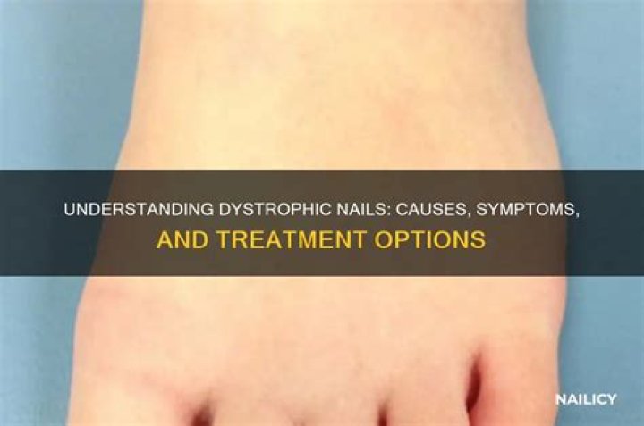 What are dystrophic nails