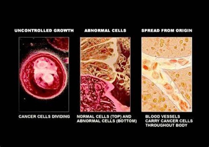 What are normal cells