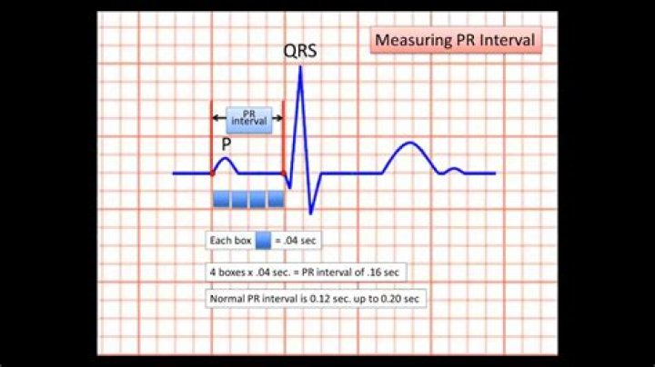 What are telemetry strips