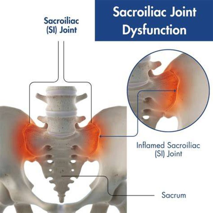 What causes accommodative dysfunction