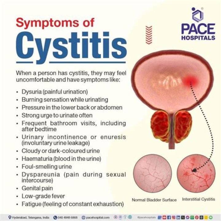 What causes acute cystitis