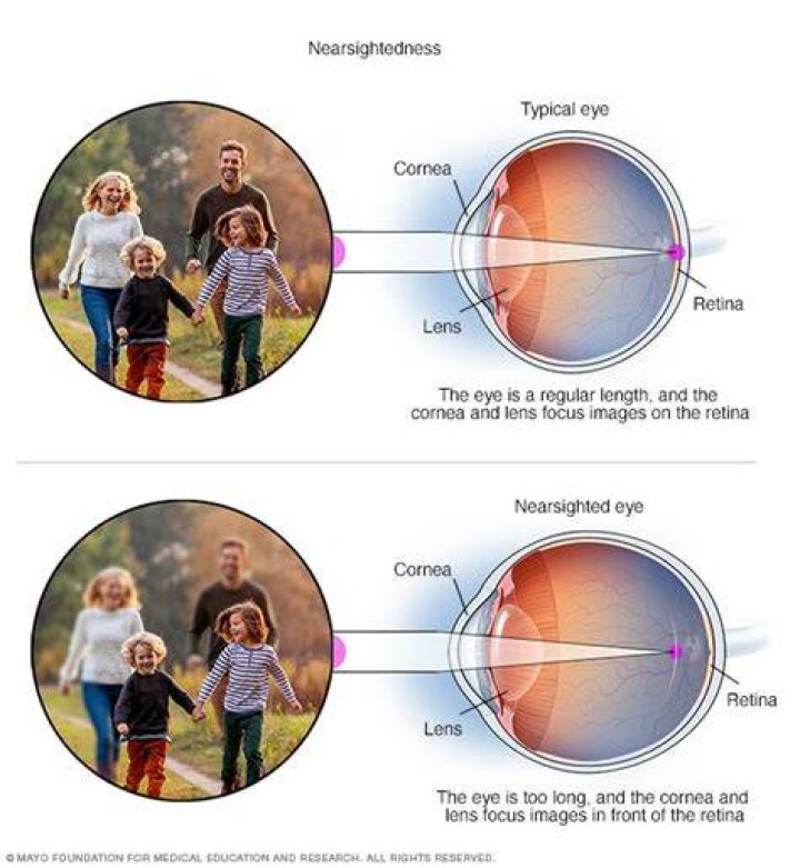 What causes blindsight