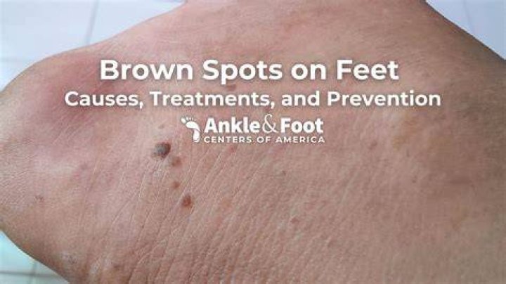 What causes brown spots on grapes