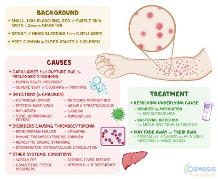 What causes Carcinosarcoma
