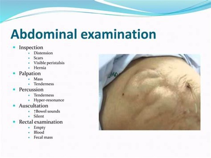What causes increased abdominal girth