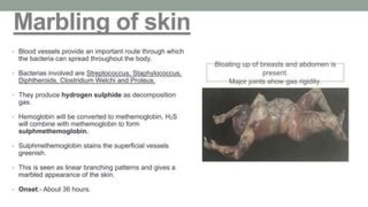 What causes marbling after death