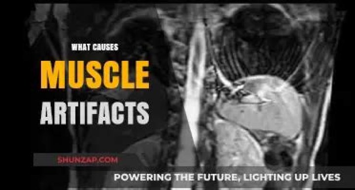What causes muscle artifacts