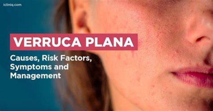 What causes verruca plana