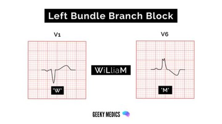 What do the right and left bundle branches do