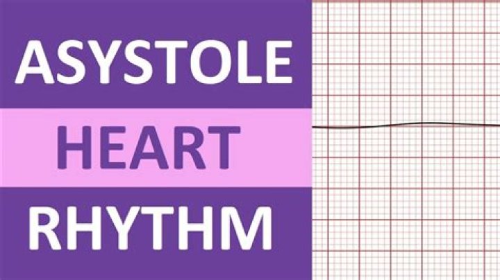 What do you do when someone has asystole