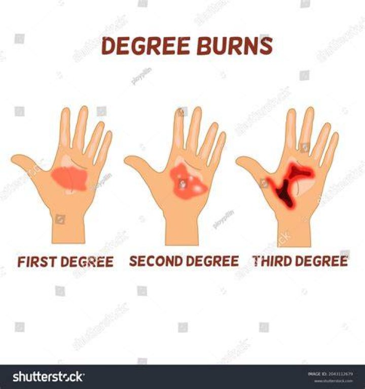 What does 3rd degree DWI mean in MN