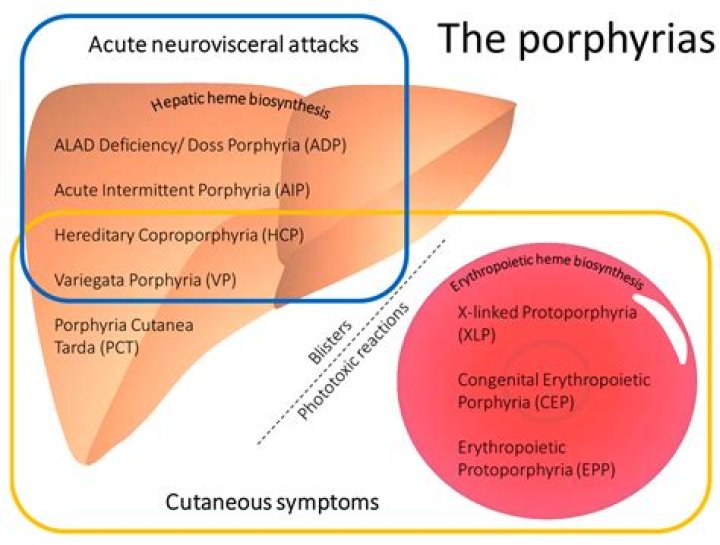 What does a porphyria attack feel like