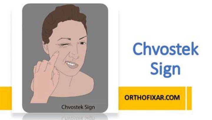 What does a positive chvosteks sign indicate
